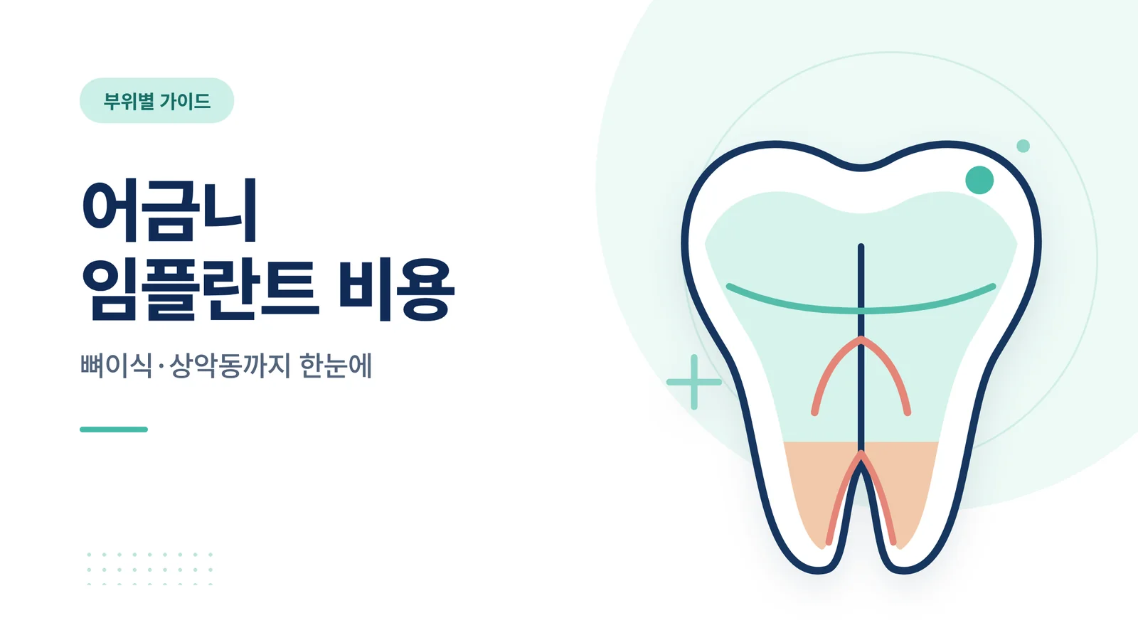 어금니 임플란트 비용